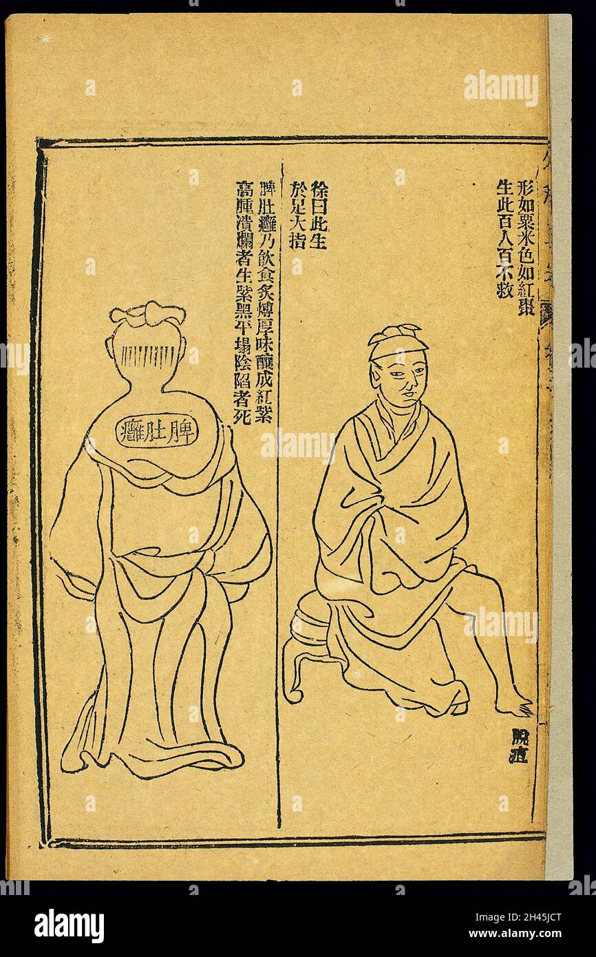 Chinese woodcut Abscesses gangrene, etc Stock Photo Alamy