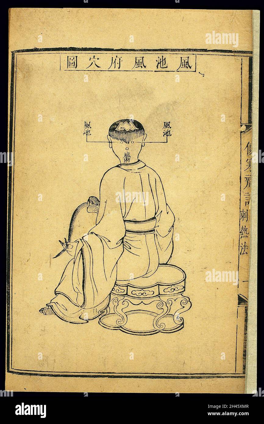 Acumoxa chart Location of the fengchi and fengfu points Stock Photo