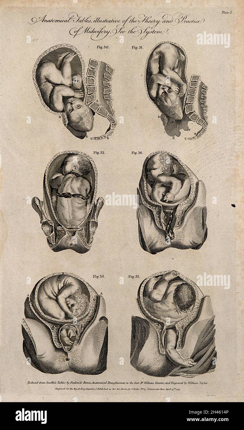 Foetuses in utero: six figures showing cross-sections of foetuses in various positions in the uterus prior to and during birth. Line engraving by W. Taylor, 1791, after F. Birnie after Smellie. Stock Photo