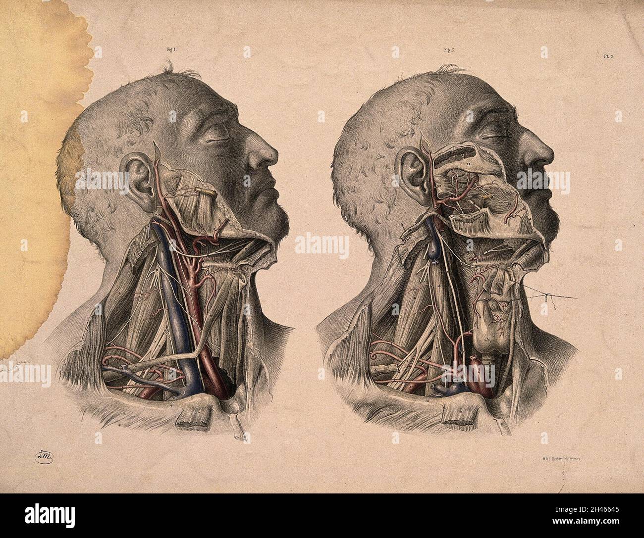 Blood-vessels of the head and neck. Coloured lithograph by J. Maclise, 1851. Stock Photo