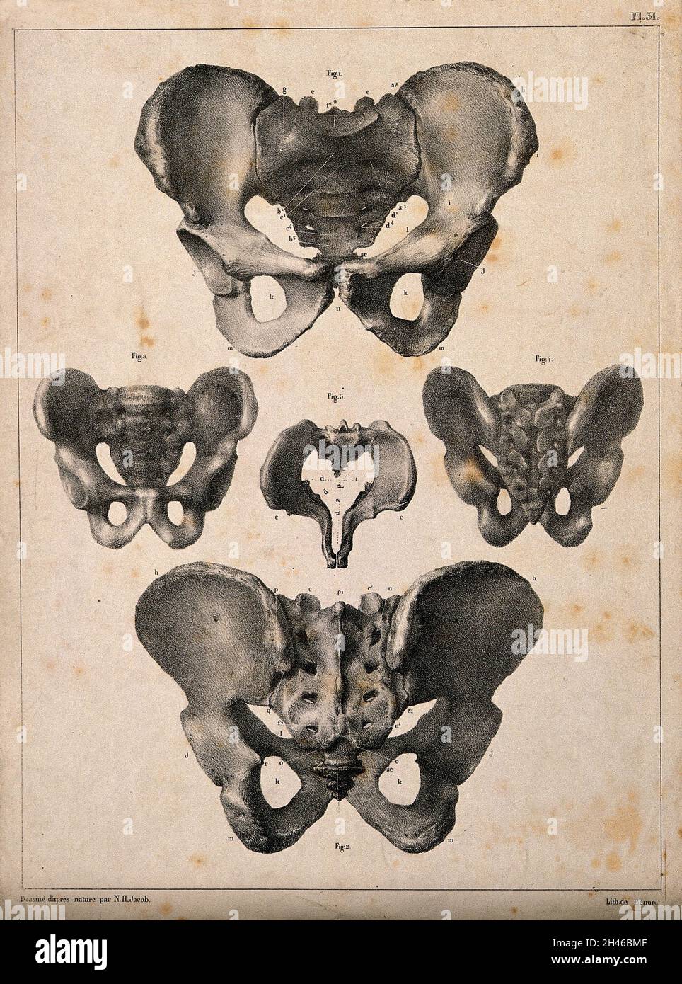 The pelvis: five figures. Lithograph by N.H Jacob, 1831/1854. Stock Photo