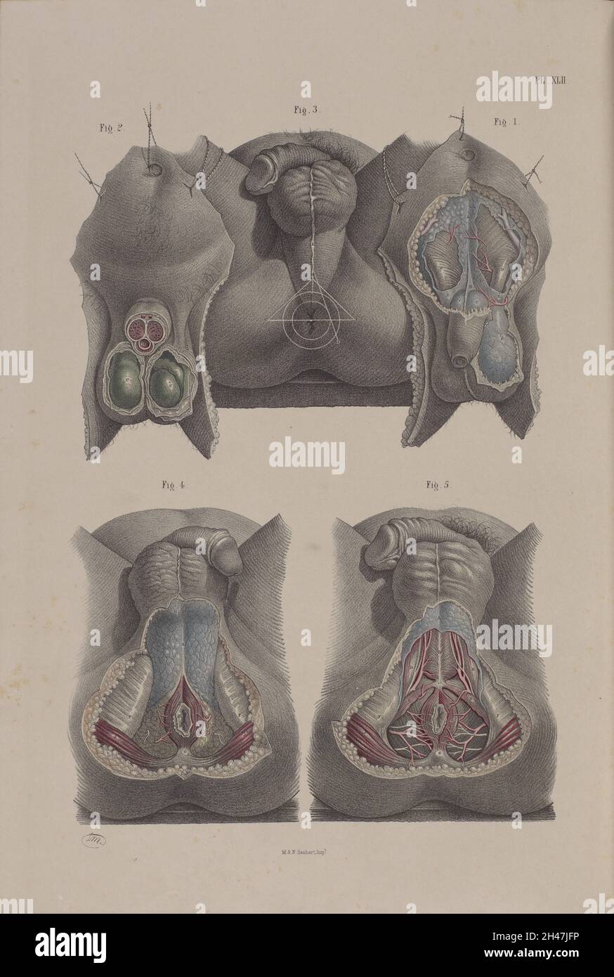 Japanese Smegma