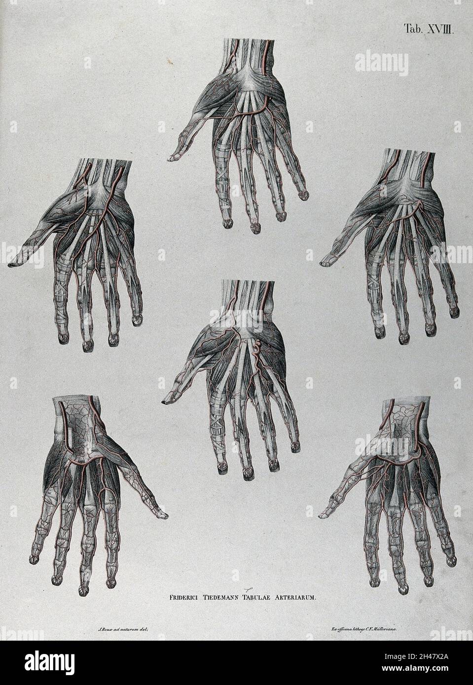 Dissections of the hand; six figures, with the arteries and blood ...