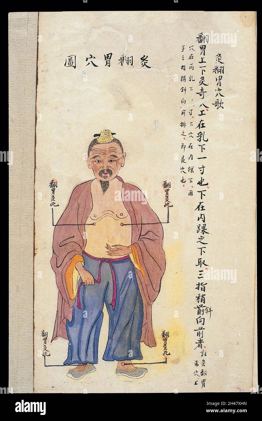 C19 Chinese MS moxibustion point chart Regurgitation points Stock