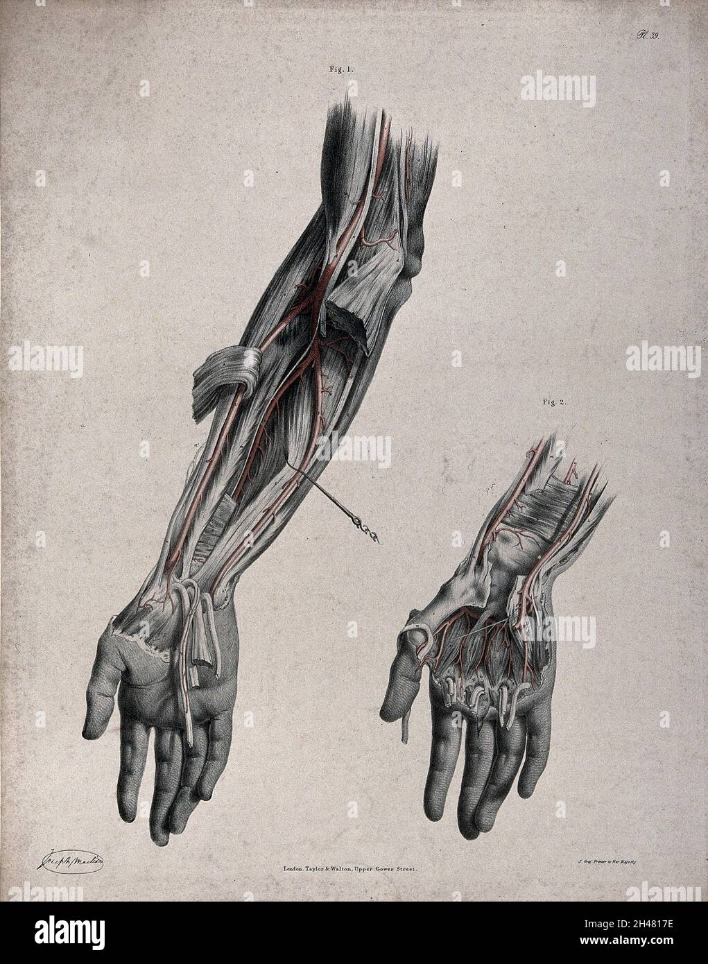 The circulatory system: two dissections of the arm and the hand, with ...