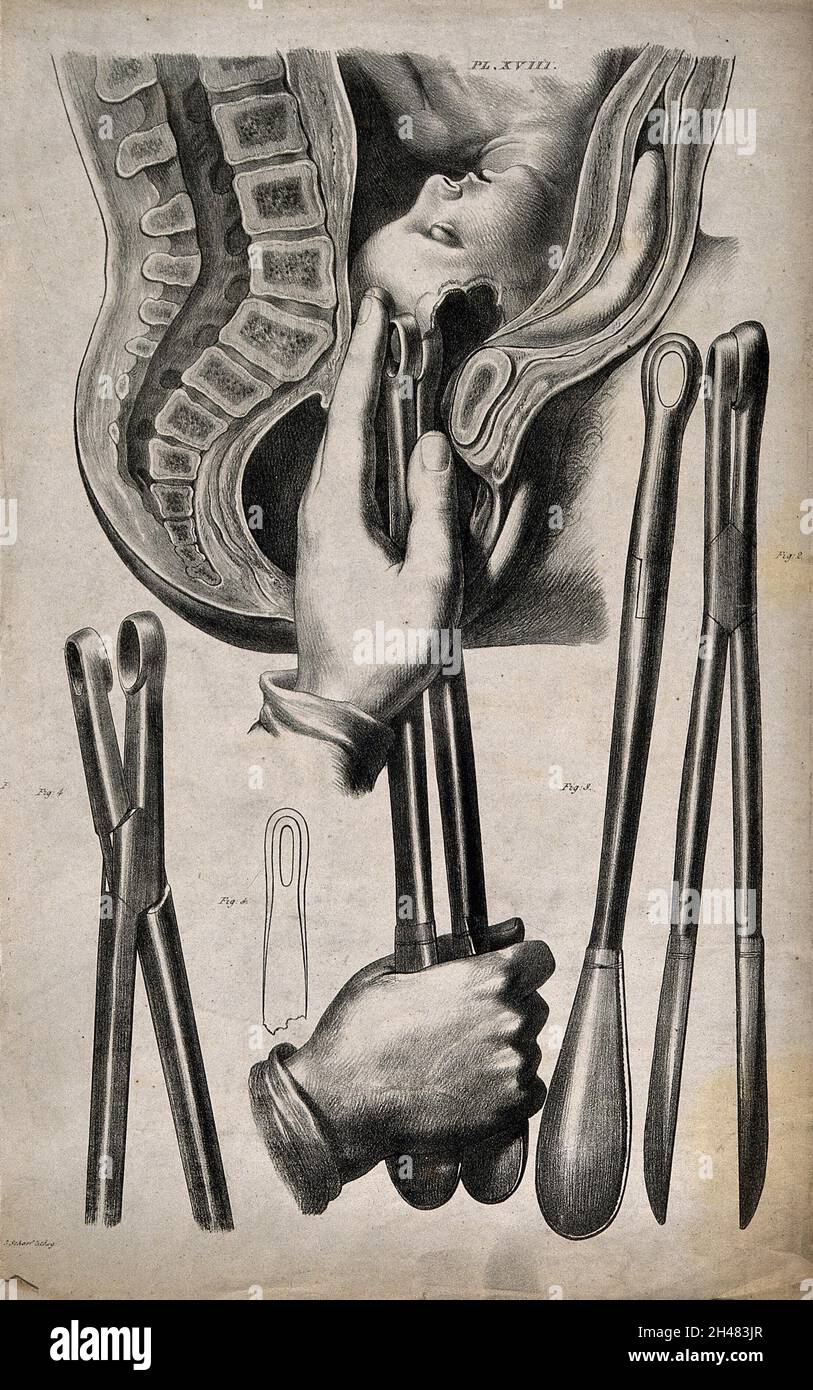 A diagram demonstrating different kinds of forceps, and their use in