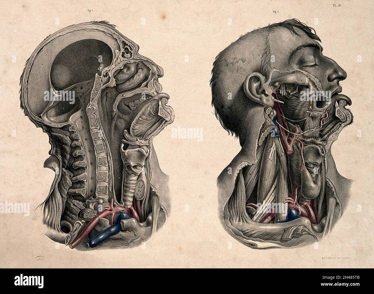 Dissection of the head and neck: two figures. Coloured lithograph by J. Maclise, 1851. Stock Photo