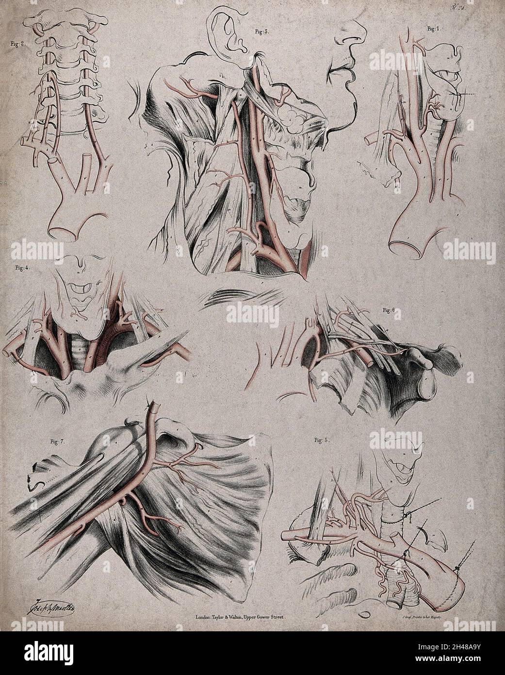 Vii Neck Dissection The circulatory system: dissections of the neck and shoulder, with ...