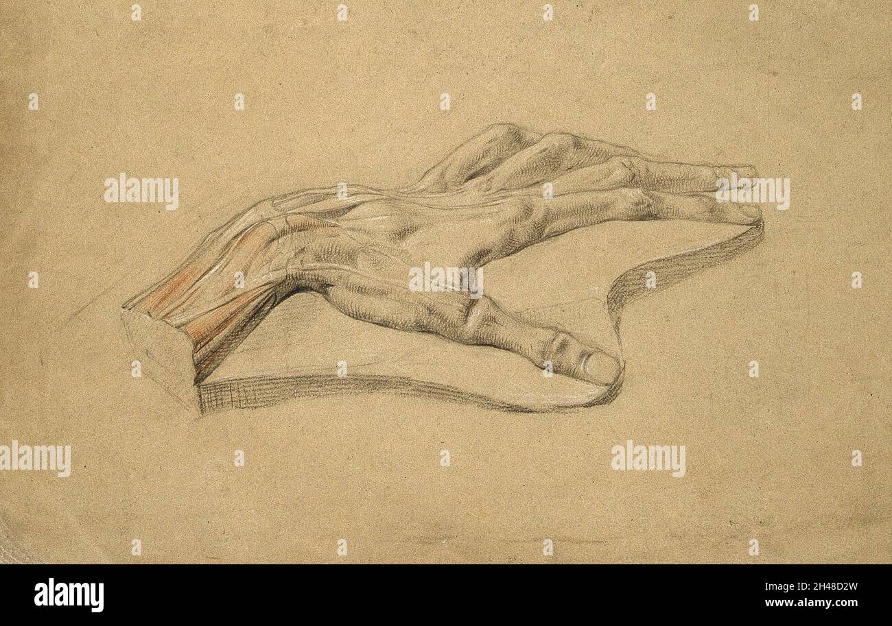 Wax(?) model of a dissected hand, showing tendons. Pencil and chalk ...