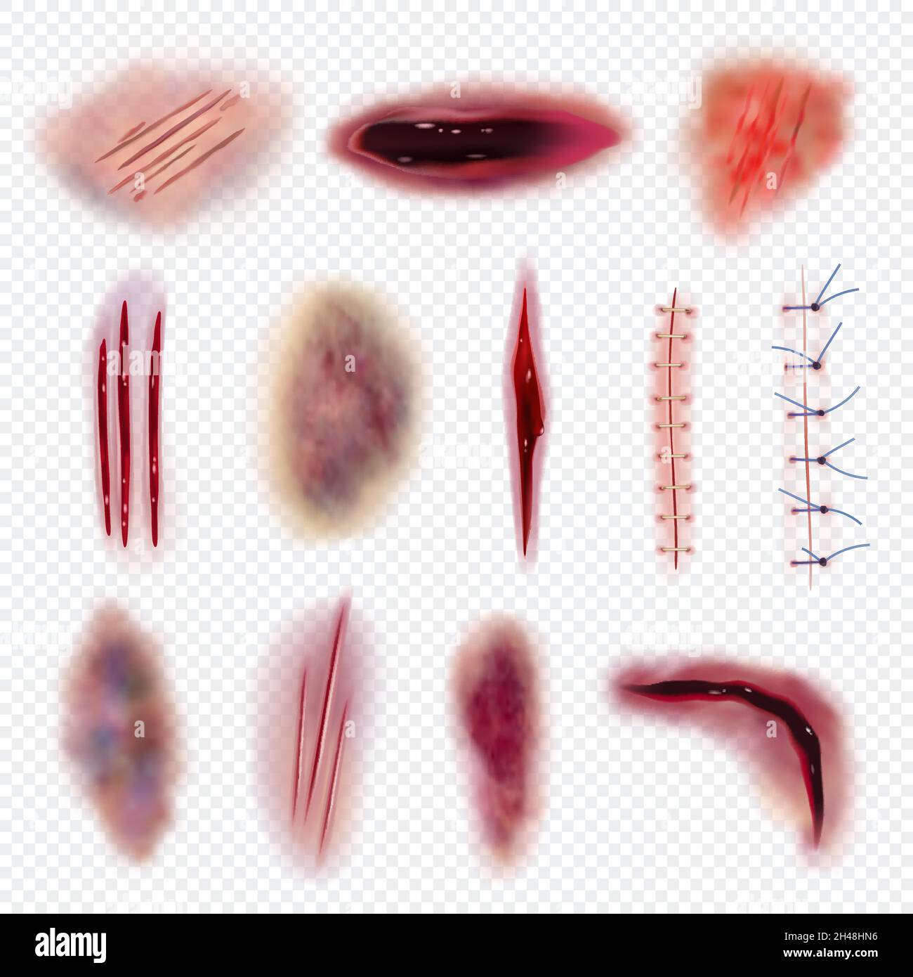 Body bruises. Injured realistic wound bloody gashes cuts and scars