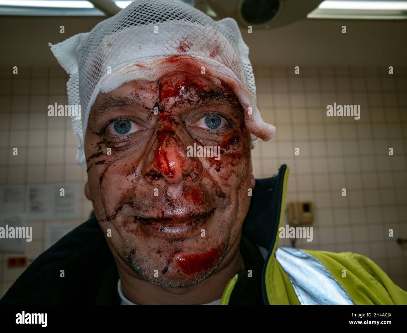 Face injury blood hi-res stock photography and images - Alamy