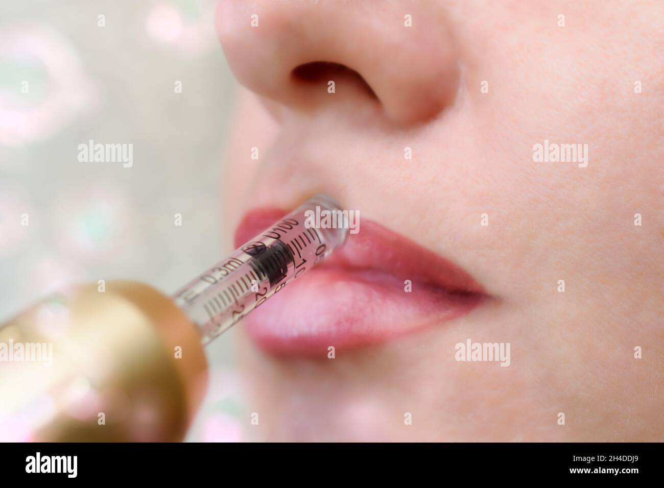 Lip augmentation treatment using needle-free mesotherapy with hyaluron pen device Stock Photo