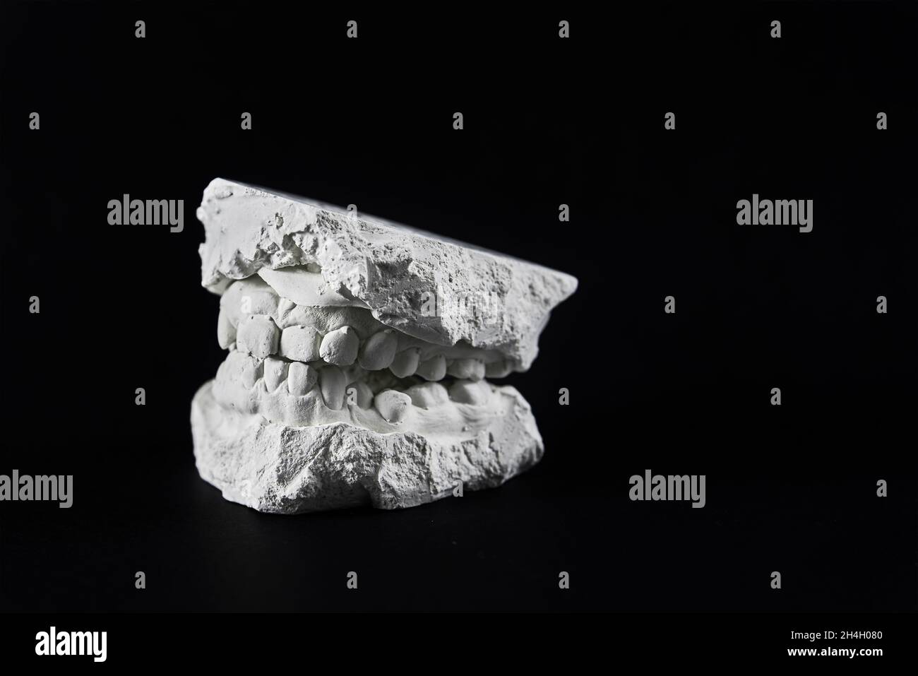 Cast of the jaw made of plaster on black background. Teeth cast for