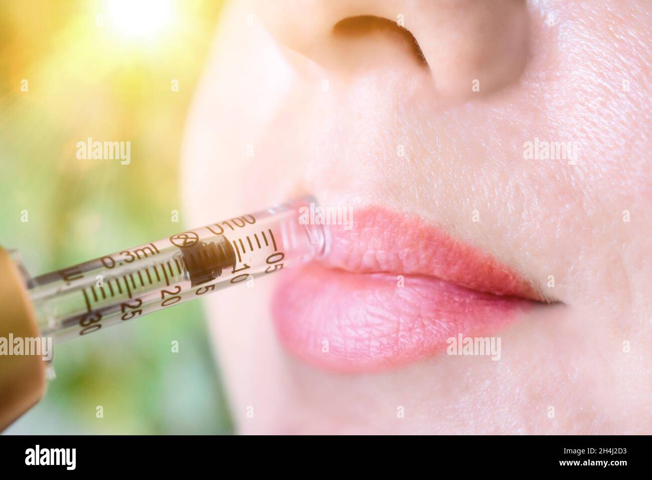 Lip augmentation treatment using needle-free mesotherapy with hyaluron pen device Stock Photo