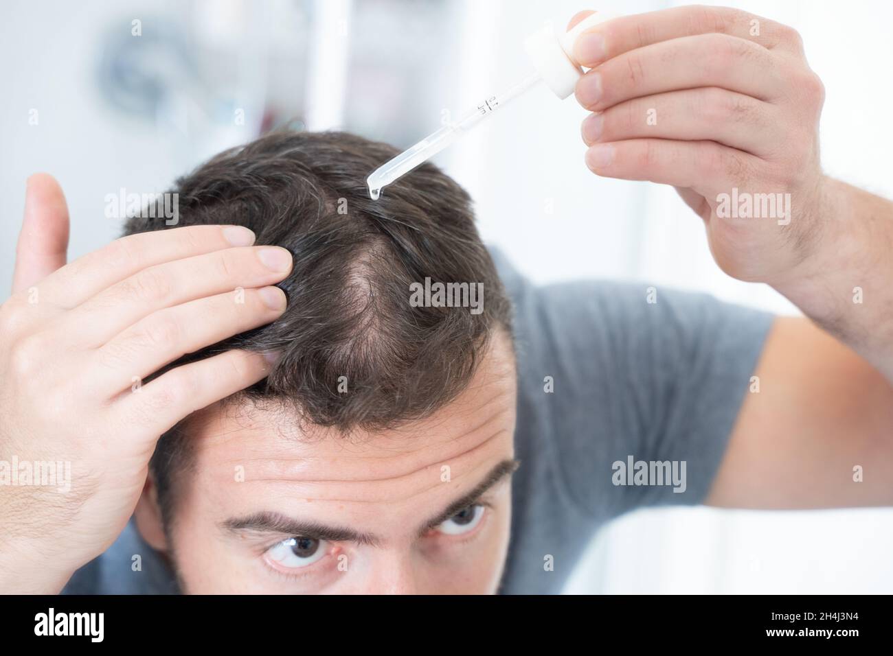 Man doing hair loss treatment as morning routine Stock Photo