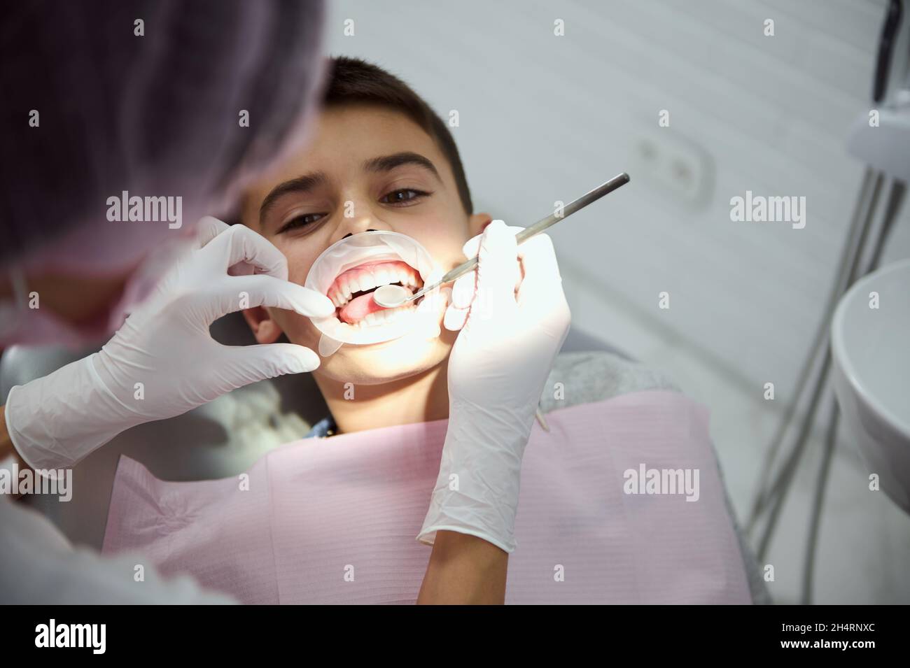 Closeup of little boy wearing dental cheek retractor during regular medical checkup. Overhead