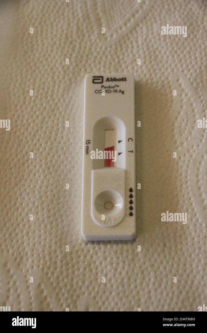 Lateral flow testing kit showing a negative result Stock Photo Alamy