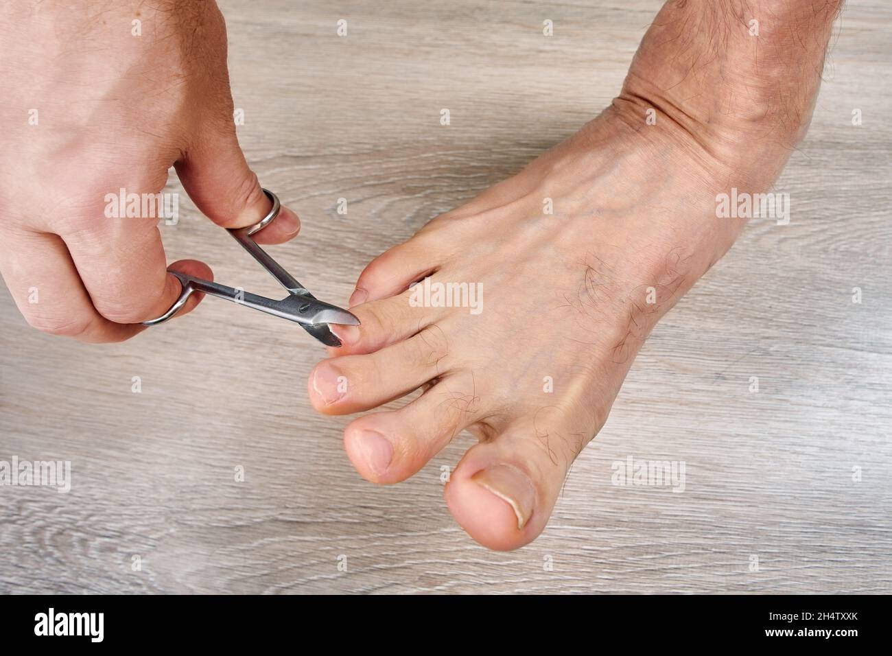 https://c8.alamy.com/comp/2H4TXXK/man-trims-his-toenails-using-toe-nail-scissors-2H4TXXK.jpg