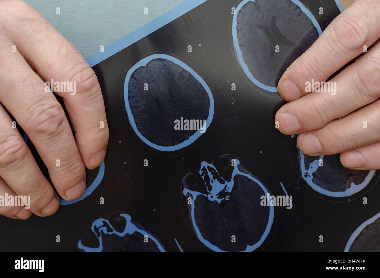 Adult male holding a CT scan of the brain. Examination of a patient in the radiology department
