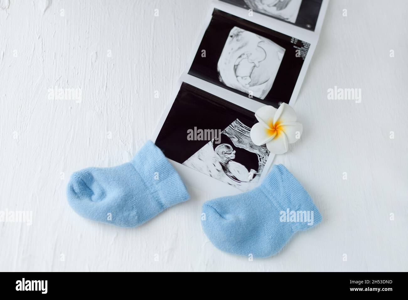 Baby boy blue socks with ultrasound tests images - pregnancy care and maternity concept. Child health Stock Photo