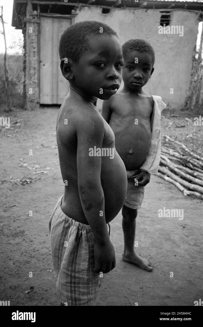 Africa, Tanzania, 1976. Ujamaa village Maasai people still live in their traditional homes. Two poor small boys with extended stomachs. Stock Photo