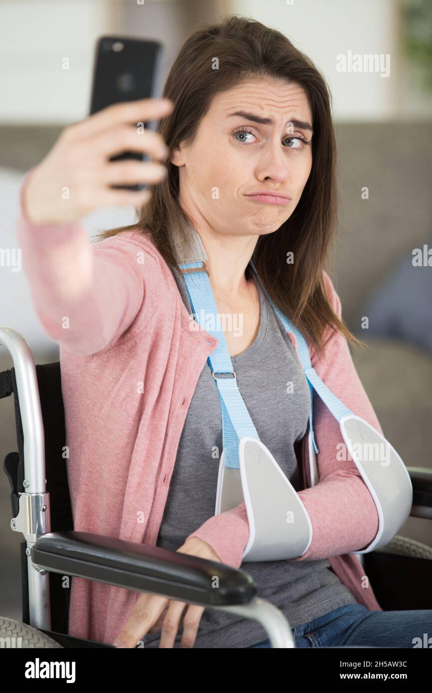 female patient with broken arm taking selfie Stock Photo Alamy