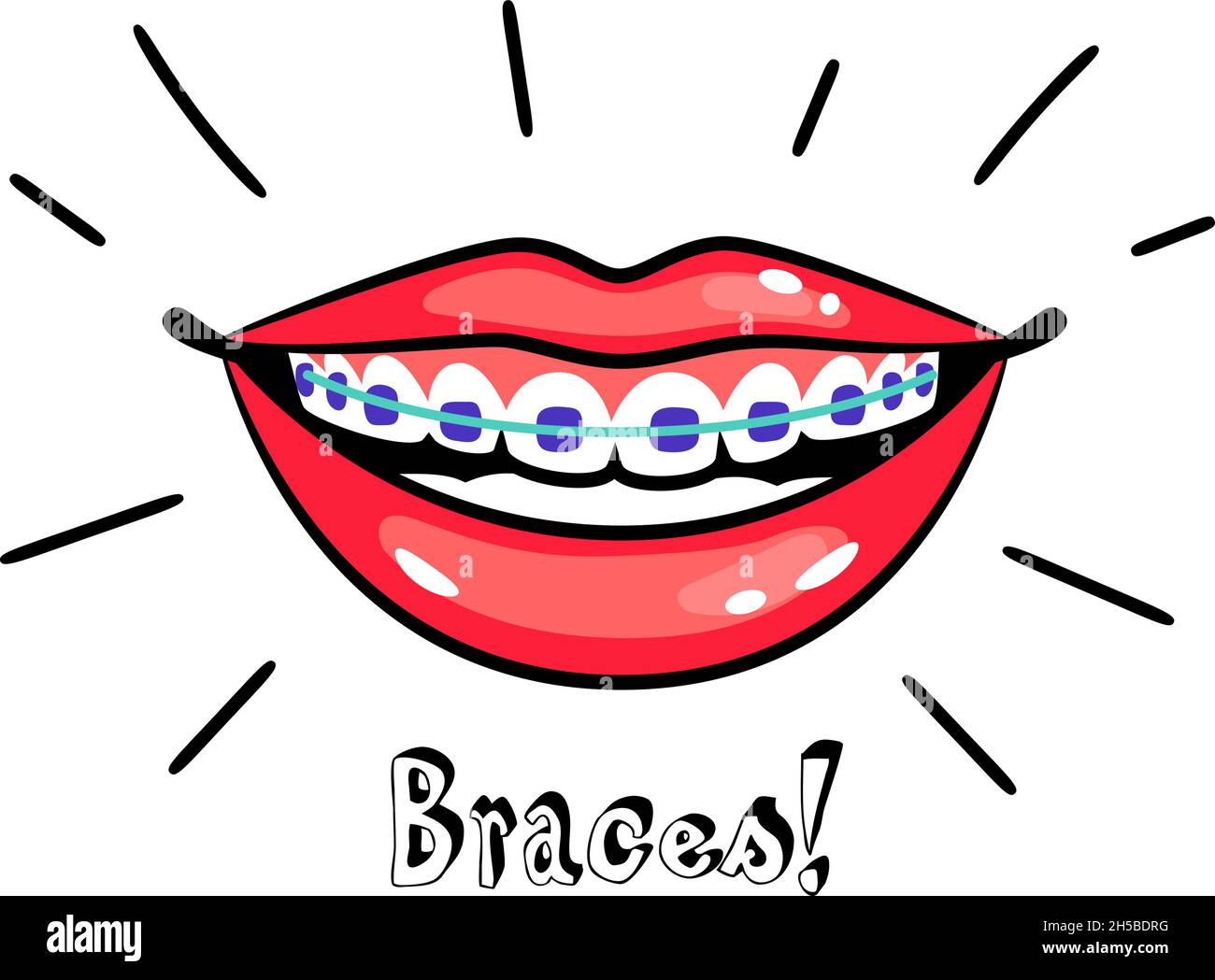 Orthodontic braces. Cartoon smile with dental braces, correct bite of