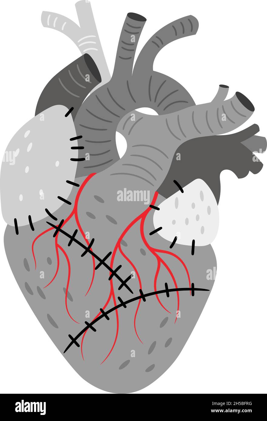 Anatomical organ. Cartoon pump for blood with muscle and veins, biological cardiovascular part of body, vector illustration of human heart with stitches isolated on white background Stock Vector