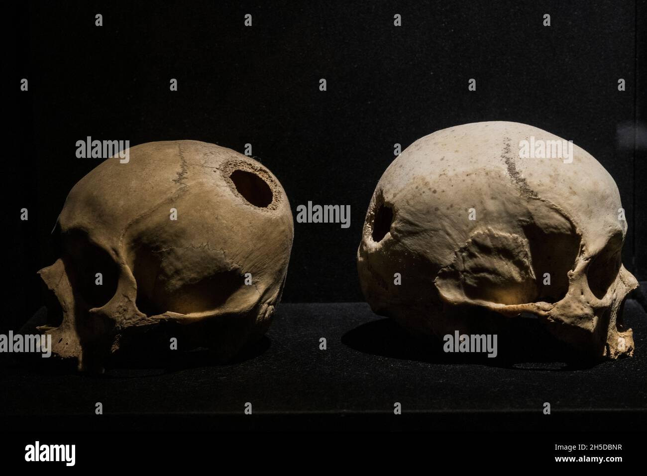 skulls with trepanation,Moche culture (100 to 700 AC). Stock Photo
