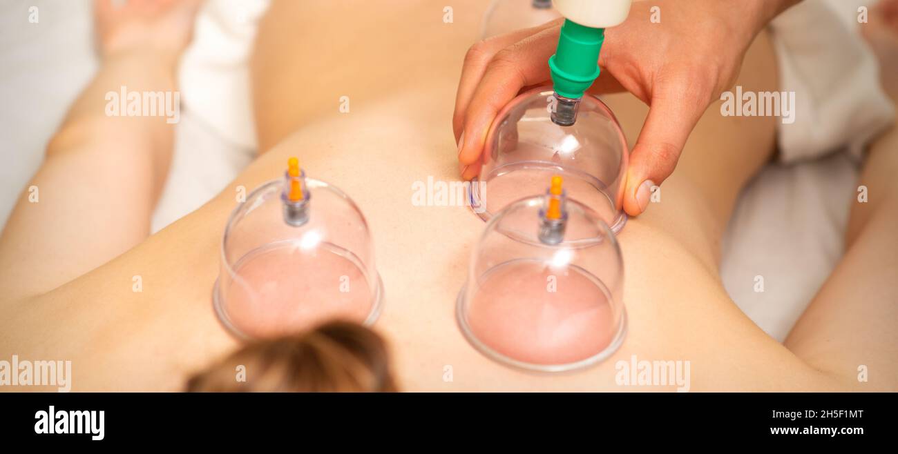 Vacuum cup hi-res stock photography and images - Alamy