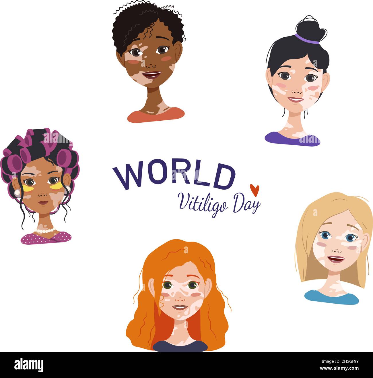 Beautiful women or girls of different nationalities, with red, blonde and black hair and melanin skin disease and text world vitiligo day. Vector flat illustration Stock Vector