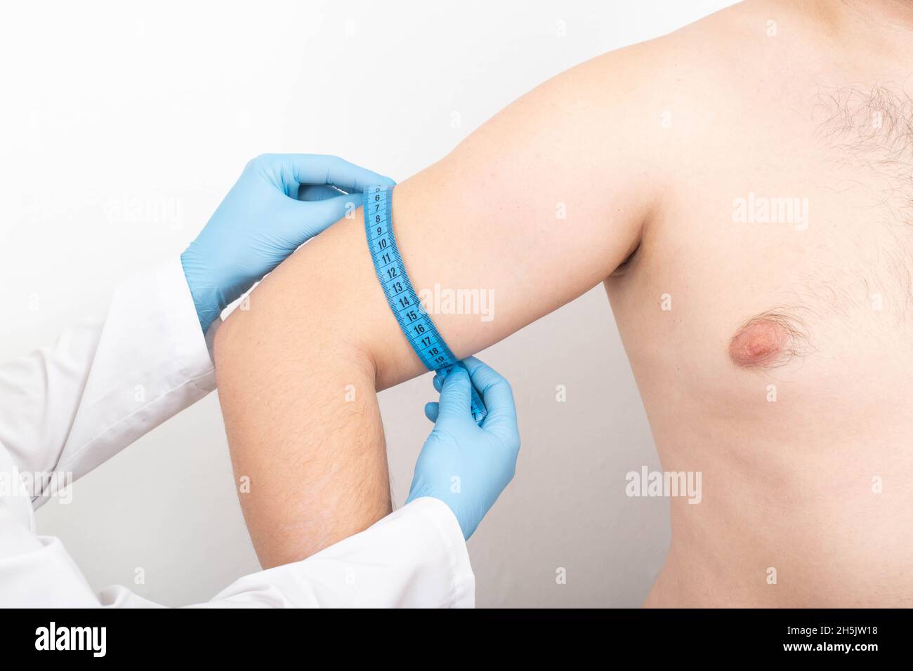 Doctor measures a man's triceps with a measuring tape for triceps augmentation with cosmetic surgery, manipulation Stock Photo