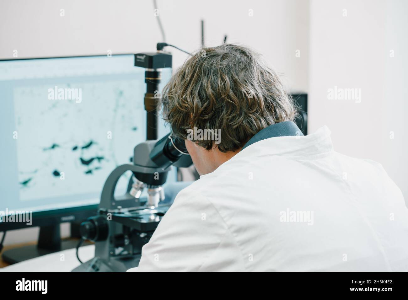 Scientist examines cannabis sativa mold through an electron microscope Stock Photo