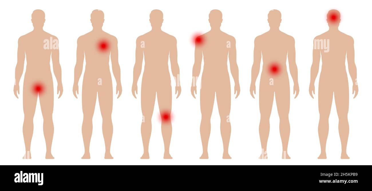 Man silhouette with red dots in different body parts. Aches and pains medical vector illustration. Stock Vector