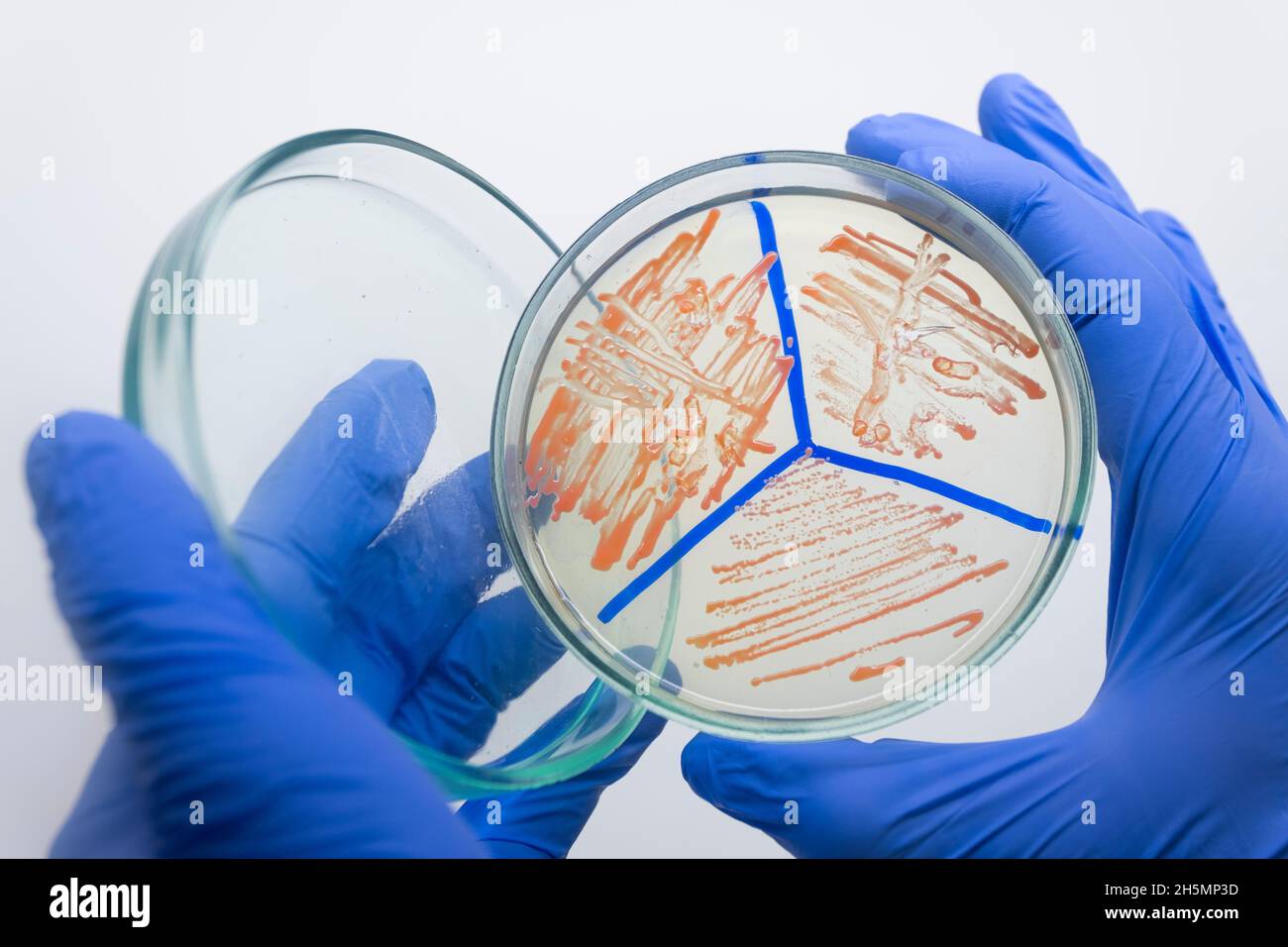 Separately growing orange bacteria on a petri dish, a scientist