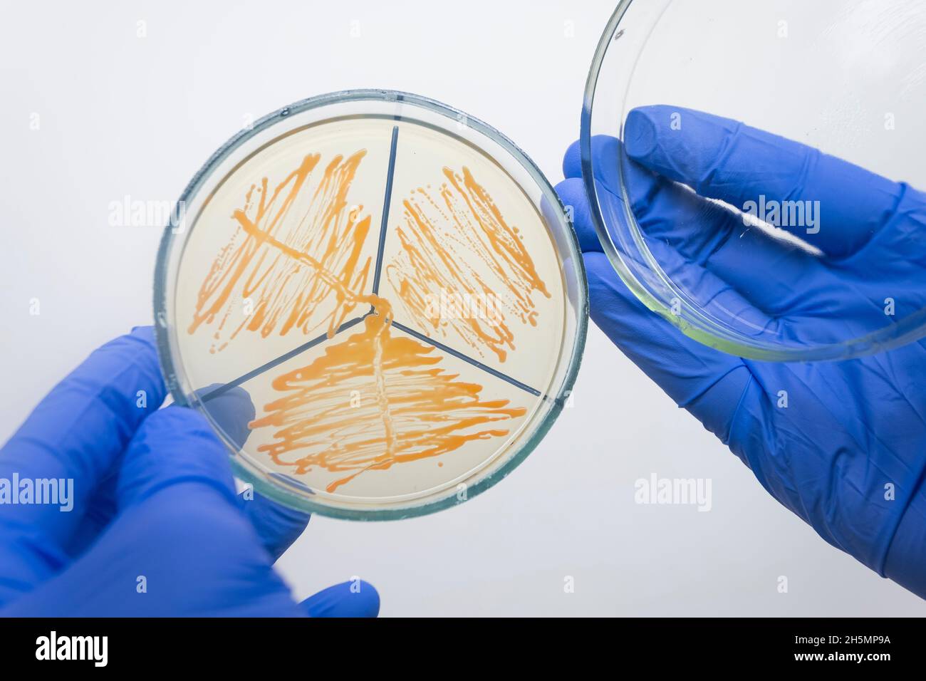 The doctor opened the lid of a petri dish, pure culture of yeast on a