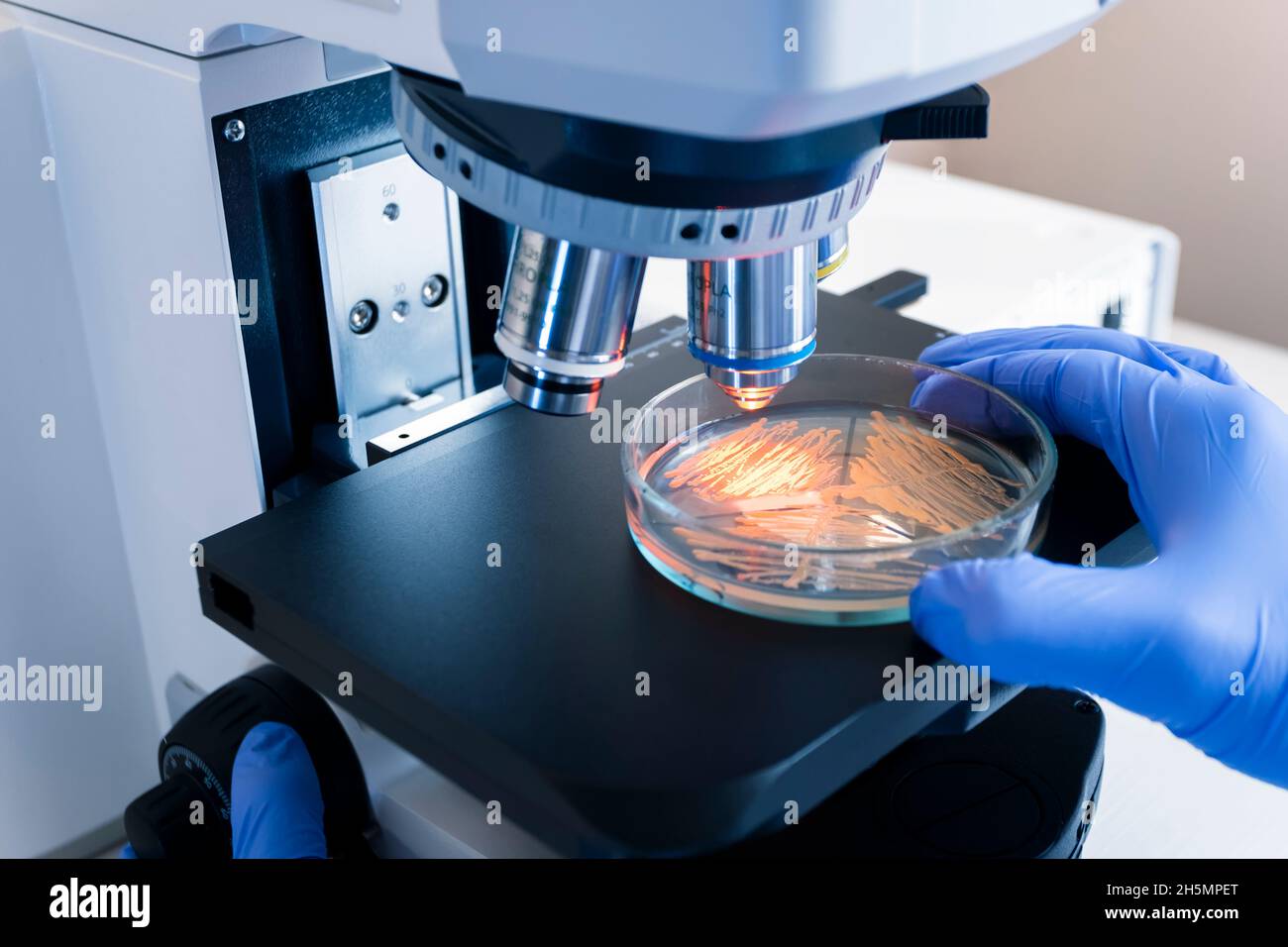A scientist holds a petri dish with bacteria colonies under a