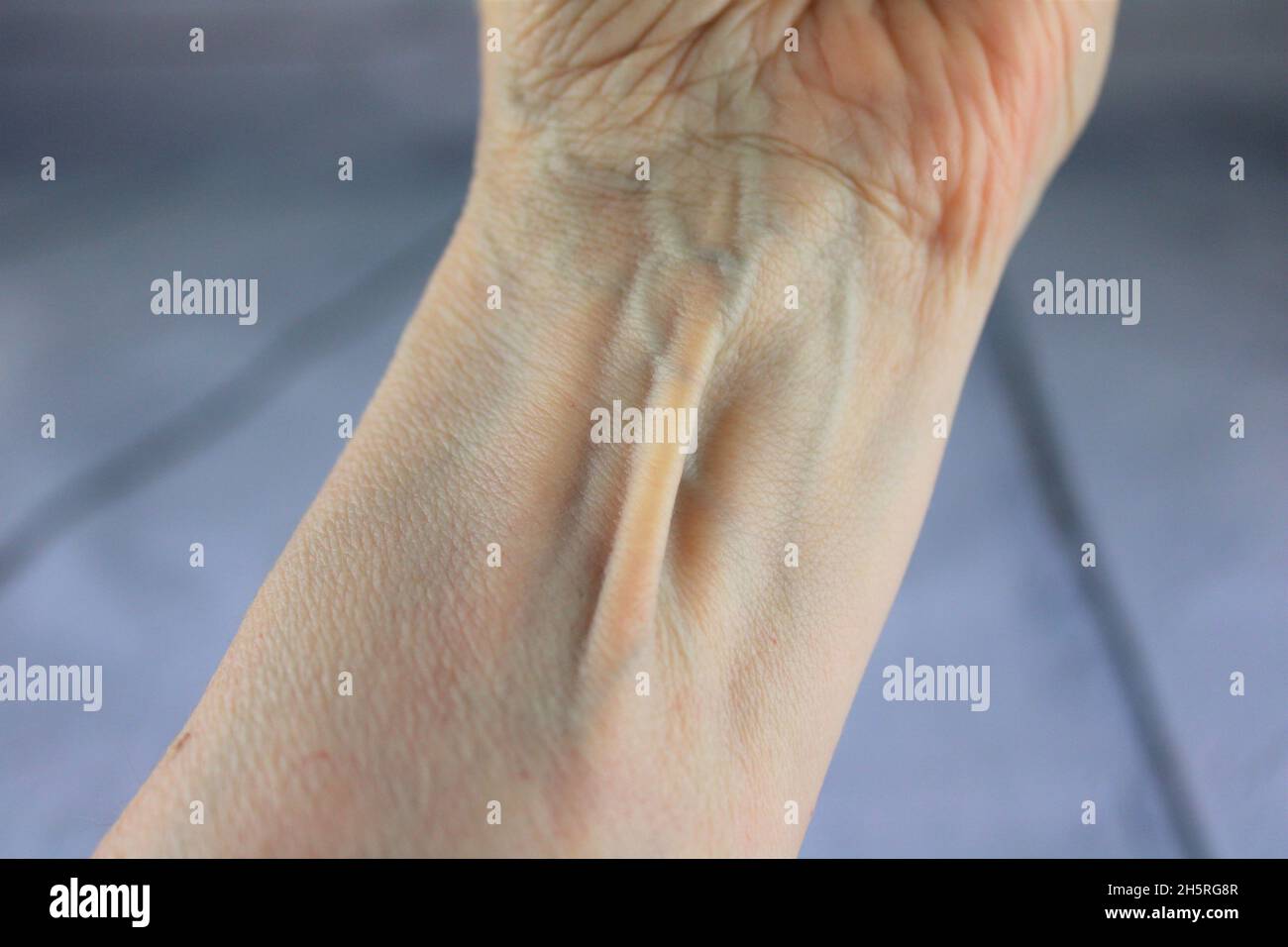 Palmaris longus muscle close up on a woman's wrist Stock Photo