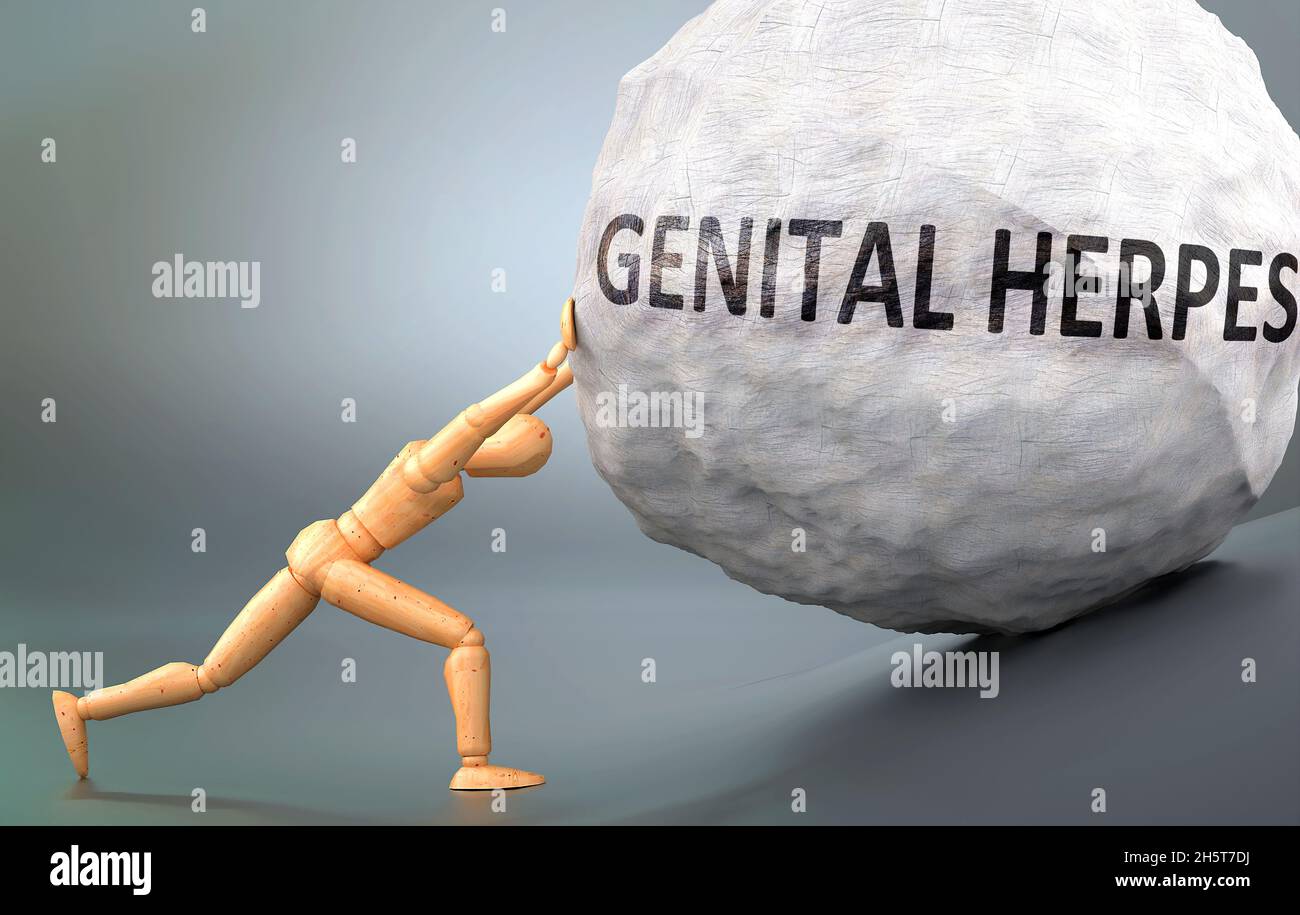Genital herpes - depiction, impression and presentation of this condition shown a wooden model pushing heavy weight to symbolize struggle and pain whe Stock Photo
