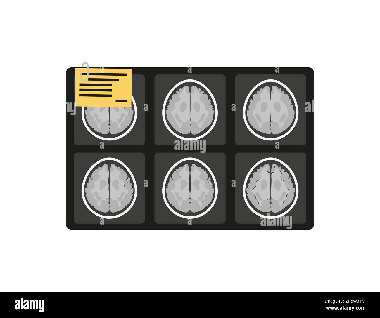 MRI x-ray brain picture in flat style, vector Stock Vector