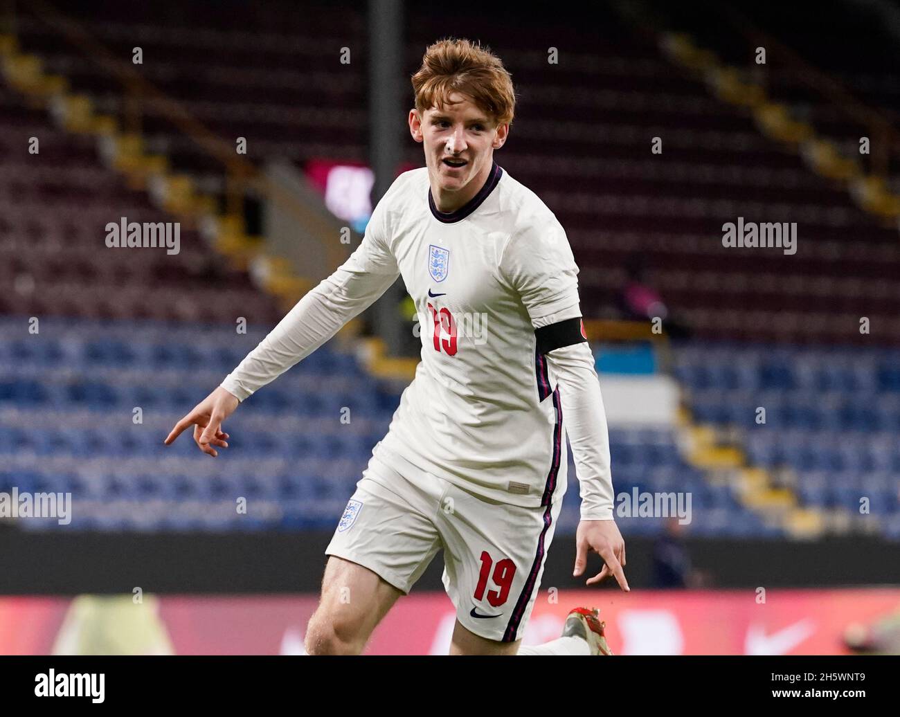 U21 LIVE  CARDIFF CITY vs BURNLEY 