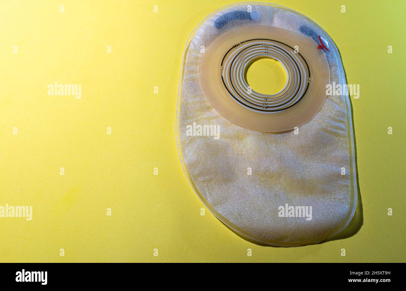 Colostomy bag hires stock photography and images Alamy