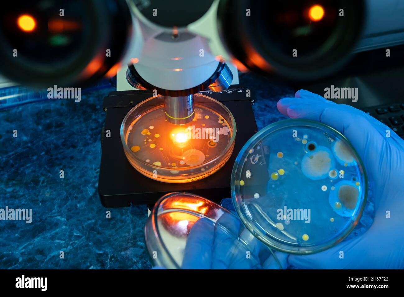 Bacteria in petri dishes are analyzed under magnification of the