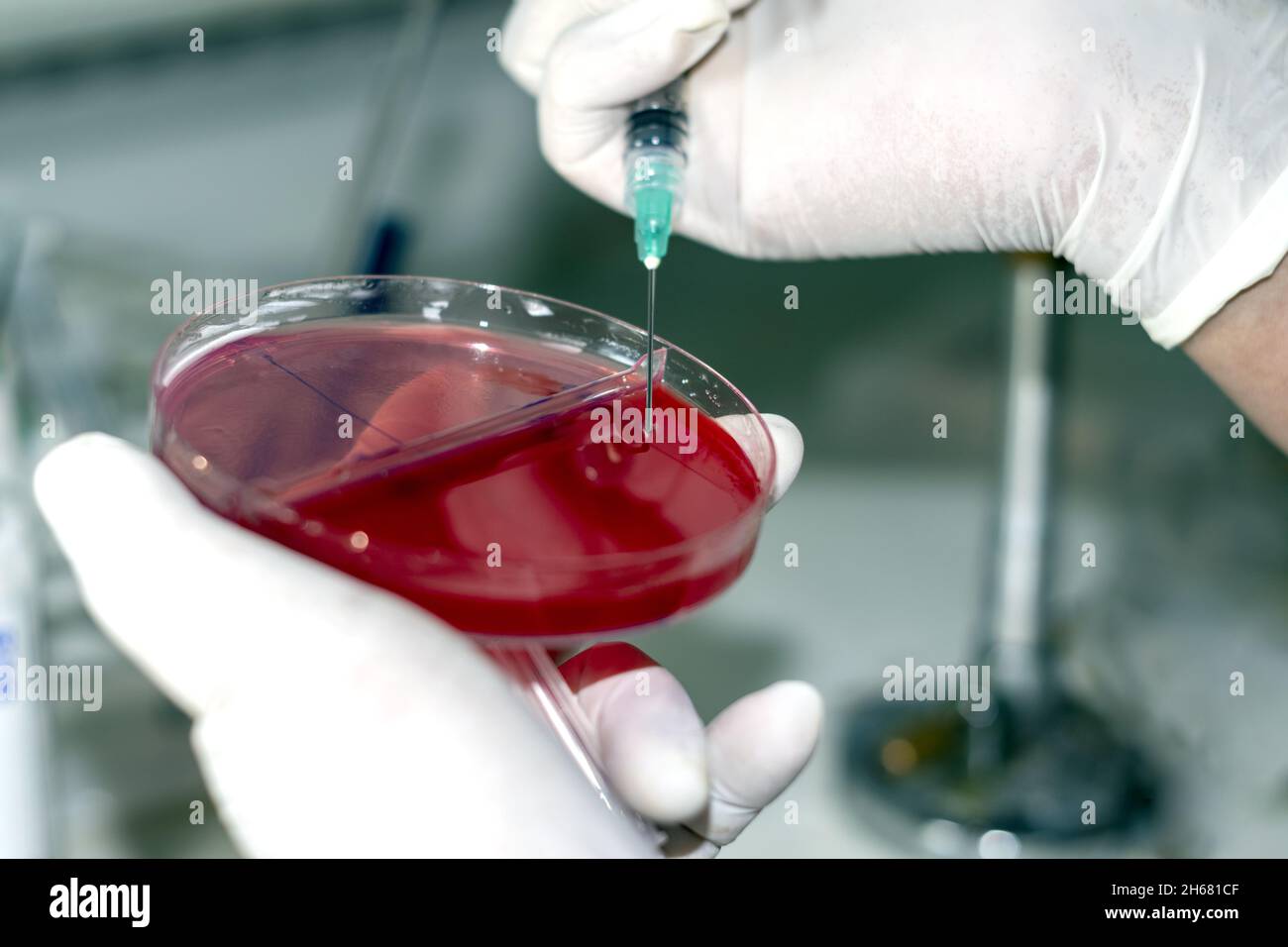 Cultivo de bacterias hi-res stock photography and images - Alamy