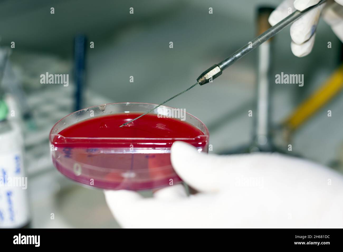 agar medio de cultivo de laboratorio clínico microbiología Stock Photo -  Alamy