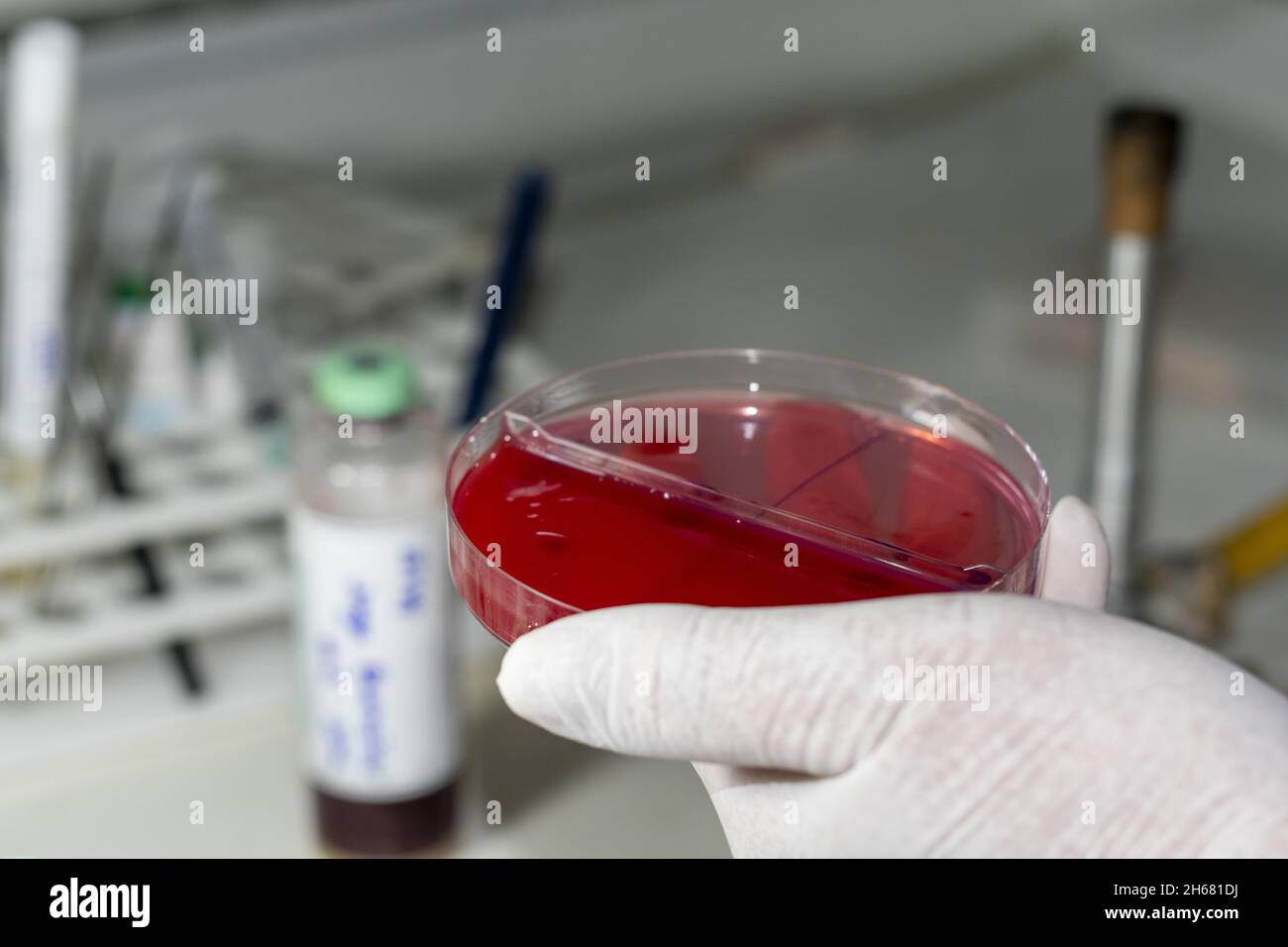 Cultivo de laboratorio hi-res stock photography and images - Alamy