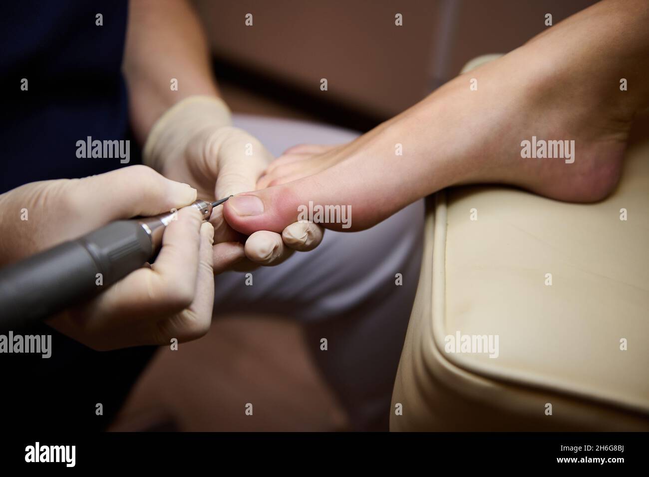 Professional pedicure using dieffenbach scalpel.Patient visiting  podiatrist.Medical pedicure procedure using special instrument with blade  knife holder.Foot treatment in SPA salon.Podiatry clinic Stock Photo by  ©juriymaslak.gmail.com 391840394