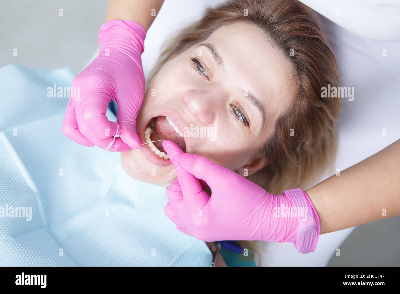 Top view close up of a mature woman having her teeth flossed by professional dentist Stock Photo