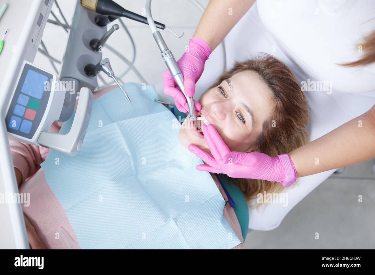 Professional Dental Cleaning Procedure – CZTFK