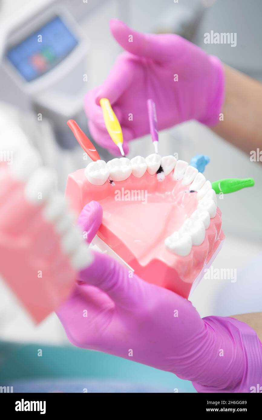 Vertical close up of jaw model with interdental brushes between teeth ...